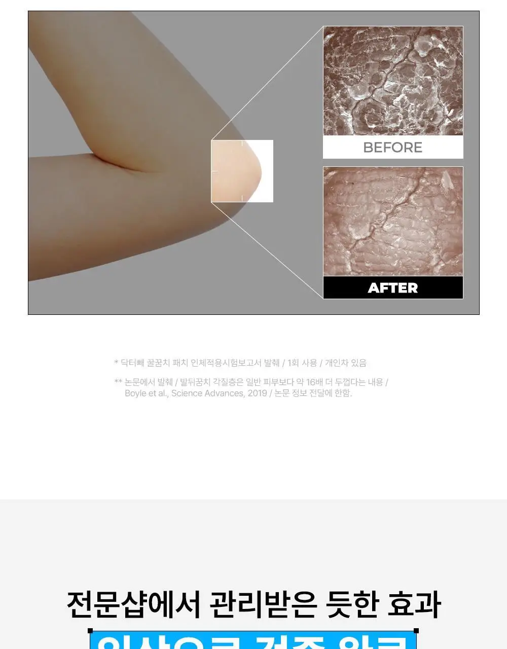 [NEW] 닥터빼 꿀꿈치 패치 1set * 4매 상세페이지 14